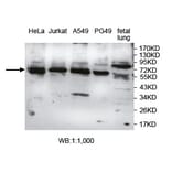 AGBL4 Antibody from Signalway Antibody (39747) - Antibodies.com