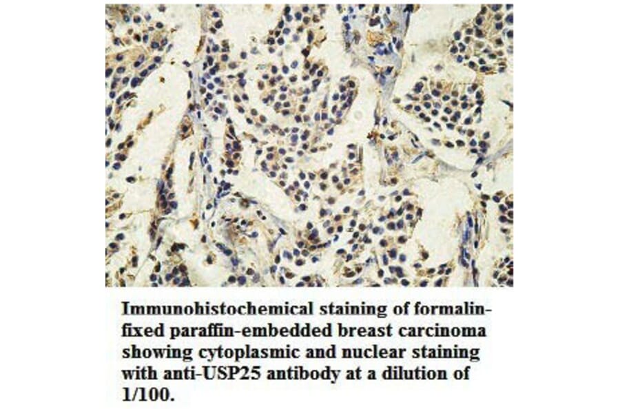 USP25 Antibody from Signalway Antibody (39749) - Antibodies.com