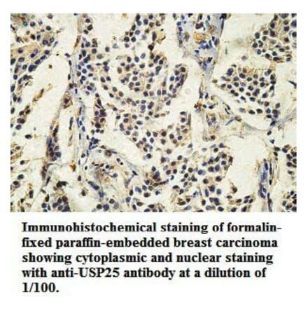 USP25 Antibody from Signalway Antibody (39749) - Antibodies.com