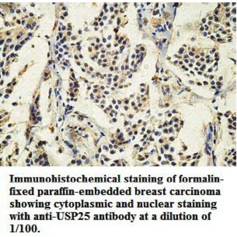 USP25 Antibody from Signalway Antibody (39749) - Antibodies.com