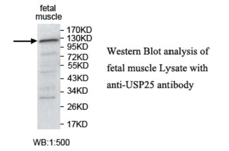 USP25 Antibody from Signalway Antibody (39749) - Antibodies.com