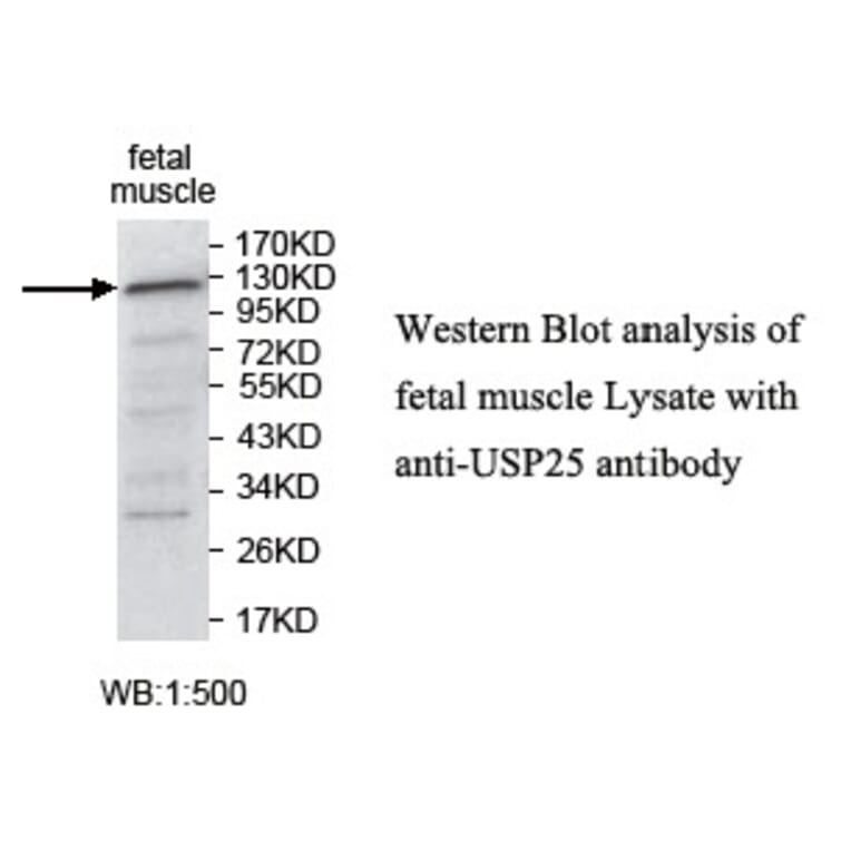 USP25 Antibody from Signalway Antibody (39749) - Antibodies.com