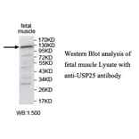 USP25 Antibody from Signalway Antibody (39749) - Antibodies.com