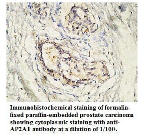 AP2A1 Antibody from Signalway Antibody (39765) - Antibodies.com