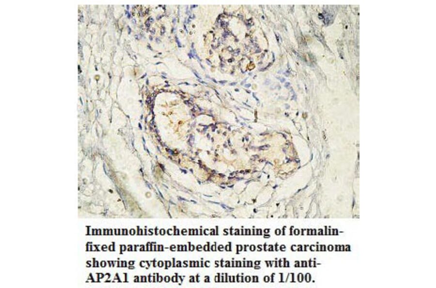 AP2A1 Antibody from Signalway Antibody (39765) - Antibodies.com