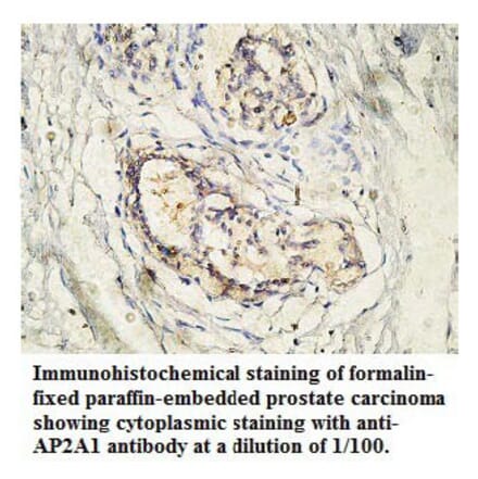 AP2A1 Antibody from Signalway Antibody (39765) - Antibodies.com