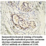 AP2A1 Antibody from Signalway Antibody (39765) - Antibodies.com