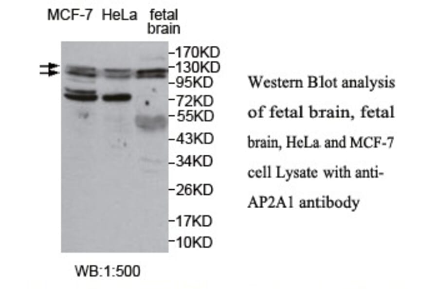 AP2A1 Antibody from Signalway Antibody (39765) - Antibodies.com