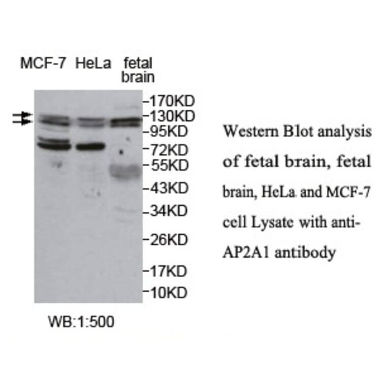 AP2A1 Antibody from Signalway Antibody (39765) - Antibodies.com