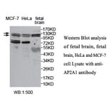 AP2A1 Antibody from Signalway Antibody (39765) - Antibodies.com