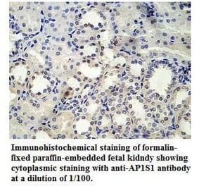AP1S1 Antibody from Signalway Antibody (39778) - Antibodies.com