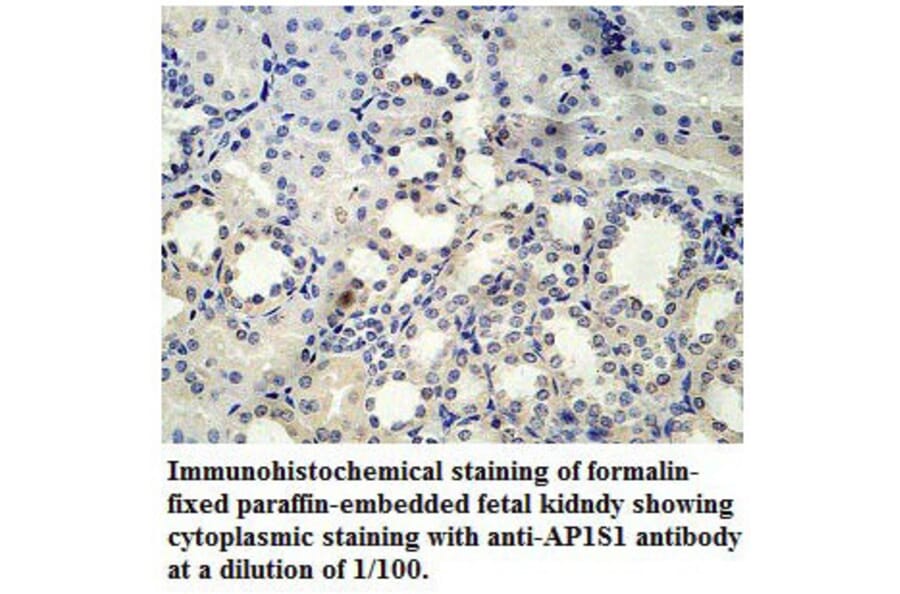 AP1S1 Antibody from Signalway Antibody (39778) - Antibodies.com