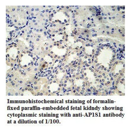 AP1S1 Antibody from Signalway Antibody (39778) - Antibodies.com