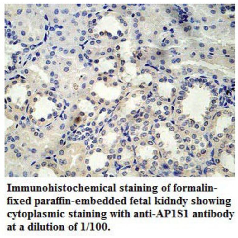 AP1S1 Antibody from Signalway Antibody (39778) - Antibodies.com