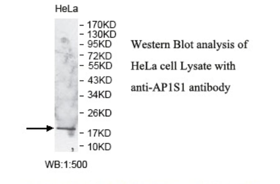 AP1S1 Antibody from Signalway Antibody (39778) - Antibodies.com