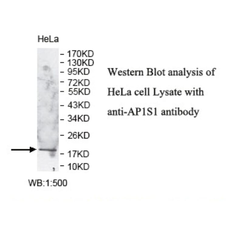 AP1S1 Antibody from Signalway Antibody (39778) - Antibodies.com