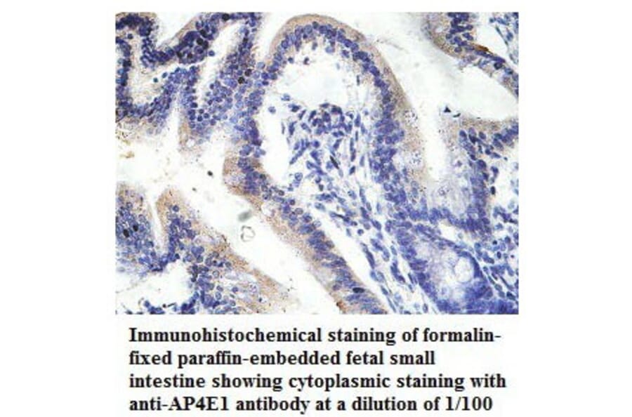 AP4E1 Antibody from Signalway Antibody (39780) - Antibodies.com