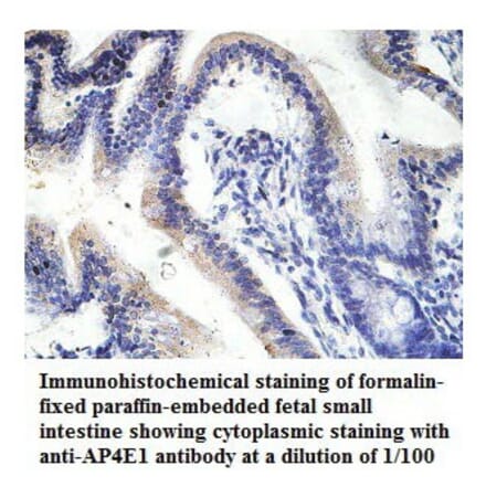 AP4E1 Antibody from Signalway Antibody (39780) - Antibodies.com