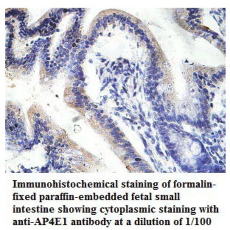 AP4E1 Antibody from Signalway Antibody (39780) - Antibodies.com