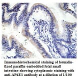 AP4E1 Antibody from Signalway Antibody (39780) - Antibodies.com