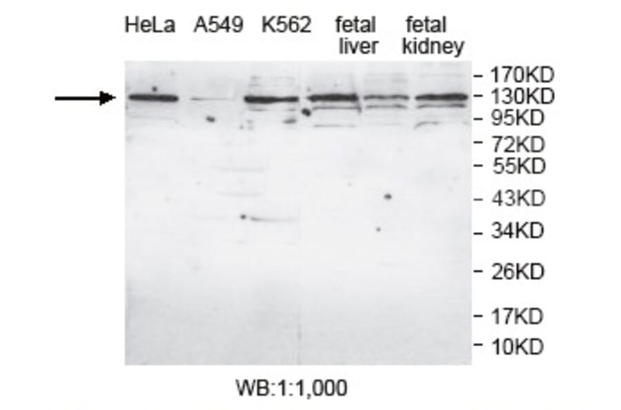 AP4E1 Antibody from Signalway Antibody (39780) - Antibodies.com