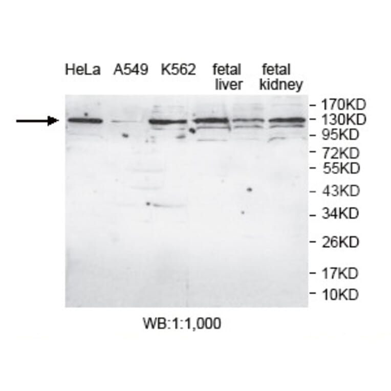 AP4E1 Antibody from Signalway Antibody (39780) - Antibodies.com