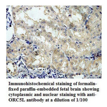 ORC5L Antibody from Signalway Antibody (39781) - Antibodies.com