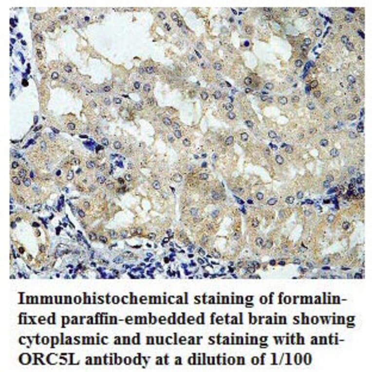 ORC5L Antibody from Signalway Antibody (39781) - Antibodies.com