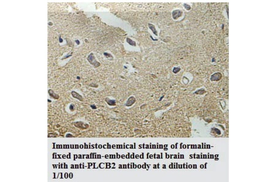 PLCB2 Antibody from Signalway Antibody (39783) - Antibodies.com