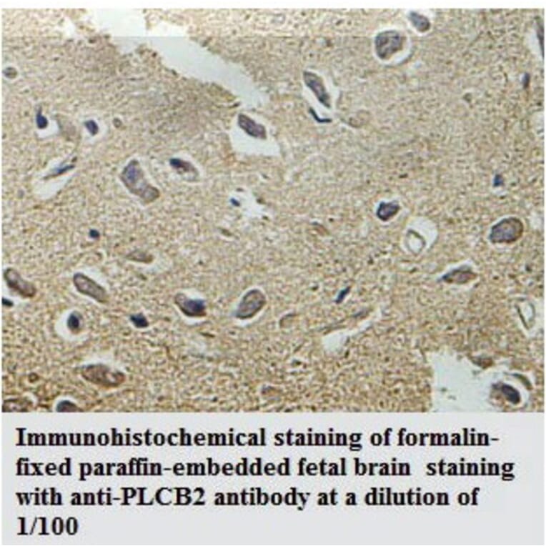 PLCB2 Antibody from Signalway Antibody (39783) - Antibodies.com