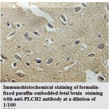 PLCB2 Antibody from Signalway Antibody (39783) - Antibodies.com