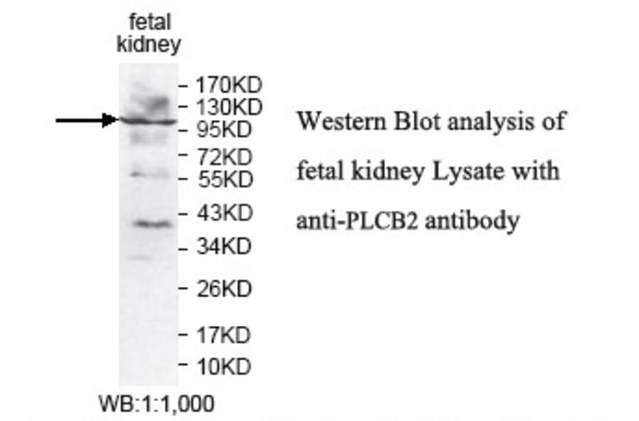 PLCB2 Antibody from Signalway Antibody (39783) - Antibodies.com