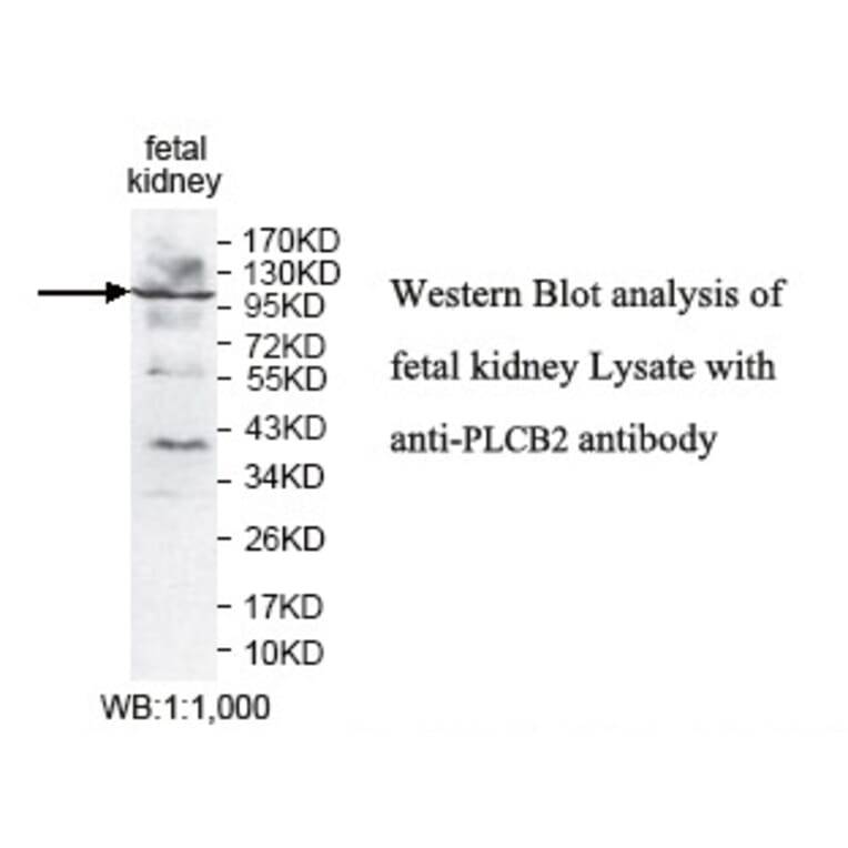 PLCB2 Antibody from Signalway Antibody (39783) - Antibodies.com