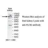 PLCB2 Antibody from Signalway Antibody (39783) - Antibodies.com