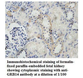 GRB14 Antibody from Signalway Antibody (39786) - Antibodies.com