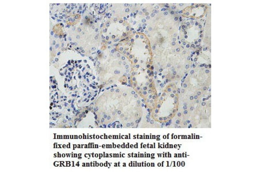 GRB14 Antibody from Signalway Antibody (39786) - Antibodies.com