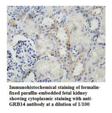GRB14 Antibody from Signalway Antibody (39786) - Antibodies.com