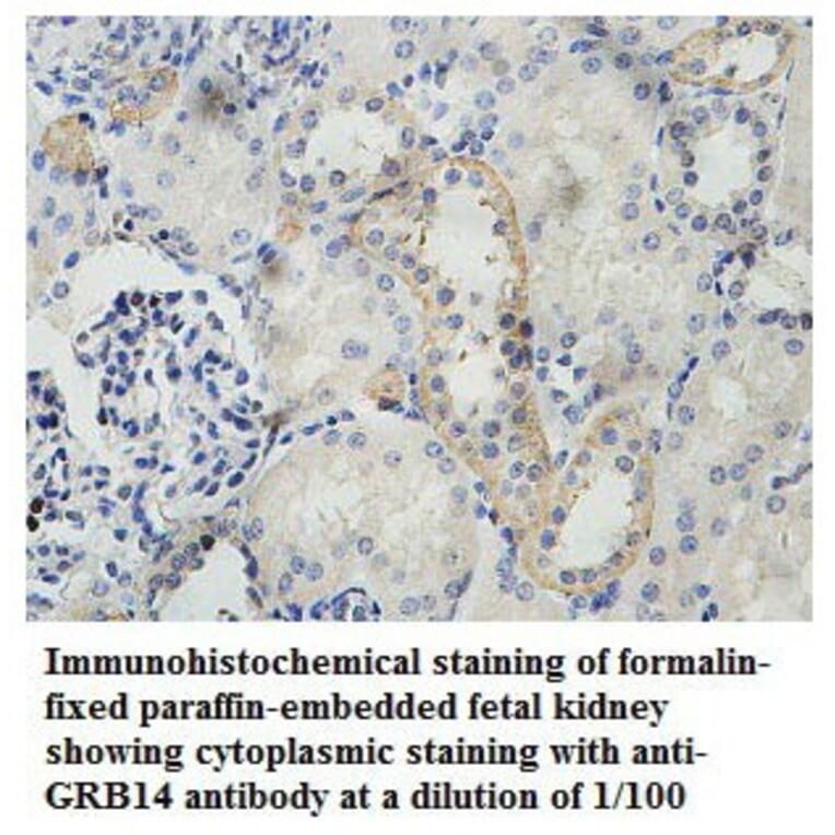 GRB14 Antibody from Signalway Antibody (39786) - Antibodies.com
