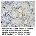 GRB14 Antibody from Signalway Antibody (39786) - Antibodies.com