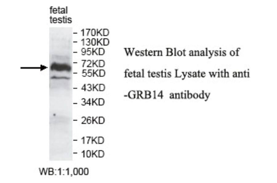 GRB14 Antibody from Signalway Antibody (39786) - Antibodies.com
