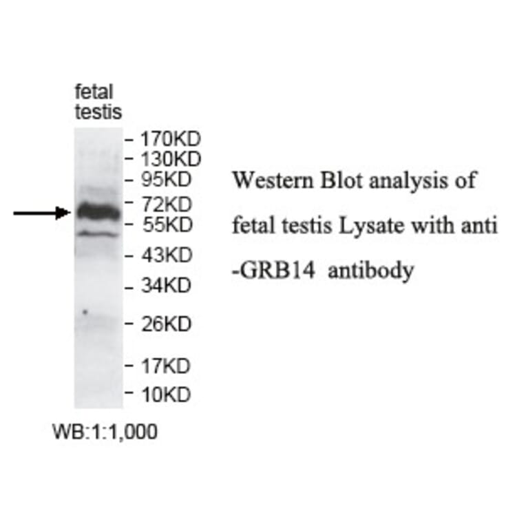 GRB14 Antibody from Signalway Antibody (39786) - Antibodies.com