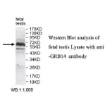 GRB14 Antibody from Signalway Antibody (39786) - Antibodies.com