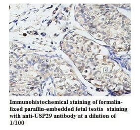 USP29 Antibody from Signalway Antibody (39787) - Antibodies.com