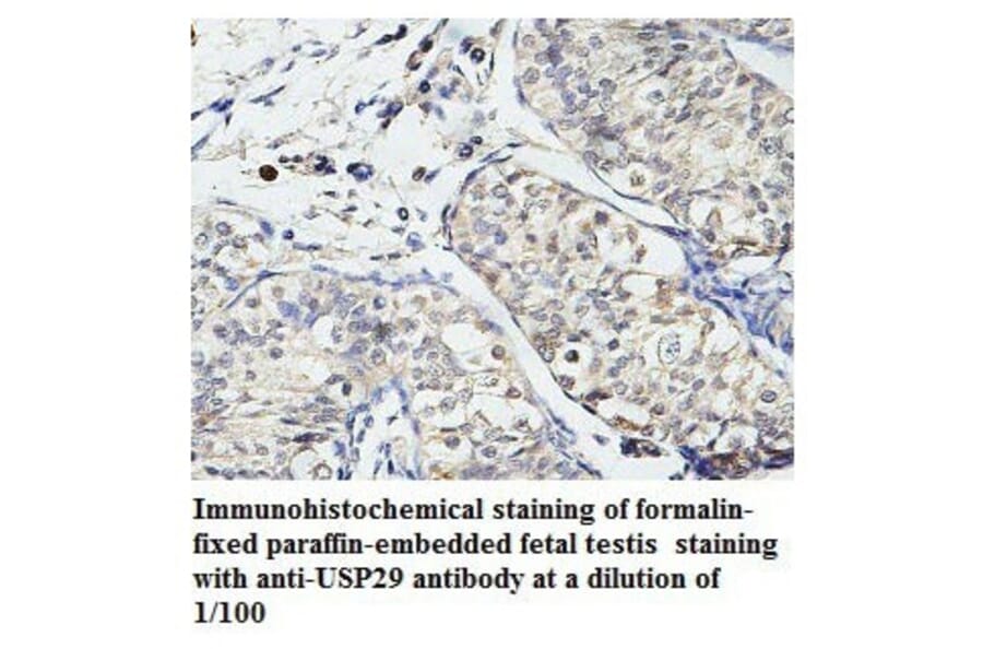 USP29 Antibody from Signalway Antibody (39787) - Antibodies.com