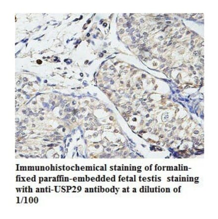 USP29 Antibody from Signalway Antibody (39787) - Antibodies.com