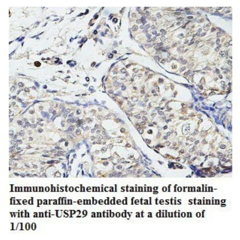 USP29 Antibody from Signalway Antibody (39787) - Antibodies.com