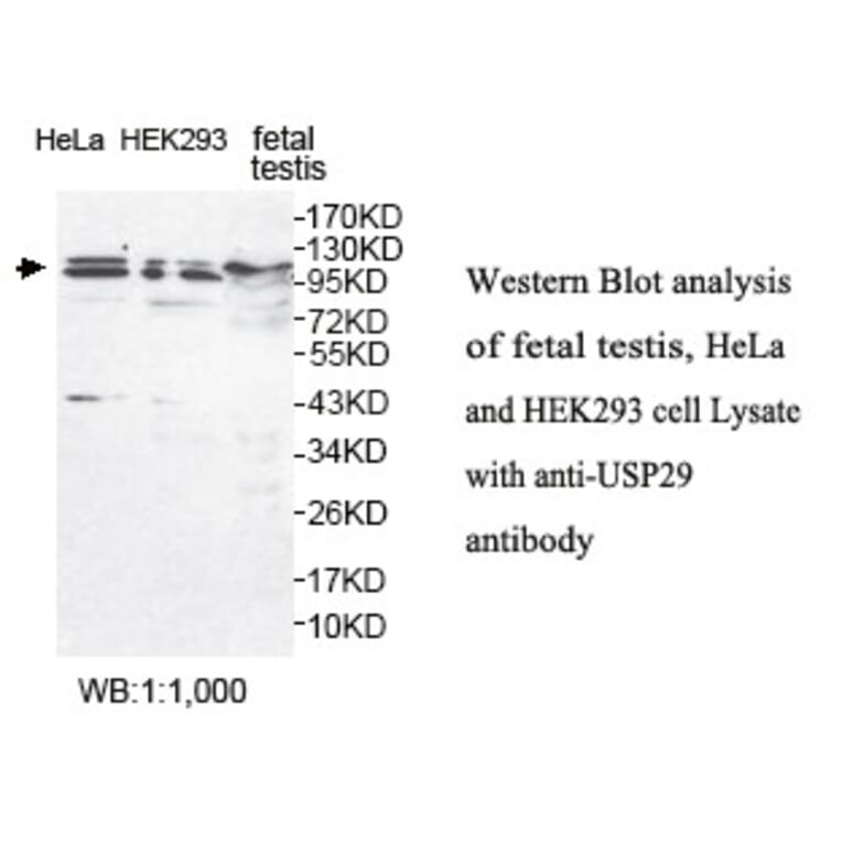 USP29 Antibody from Signalway Antibody (39787) - Antibodies.com