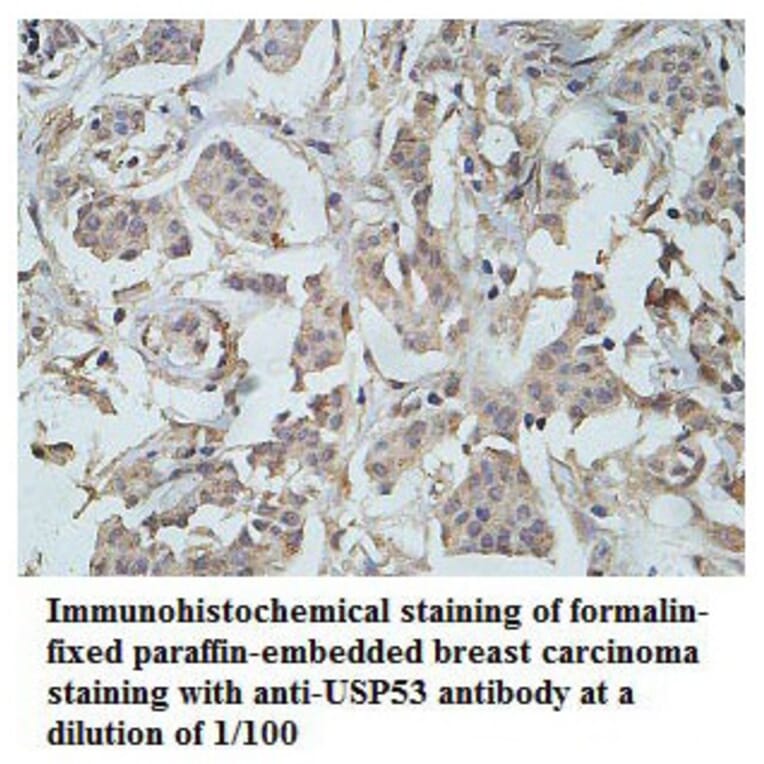 USP53 Antibody from Signalway Antibody (39788) - Antibodies.com