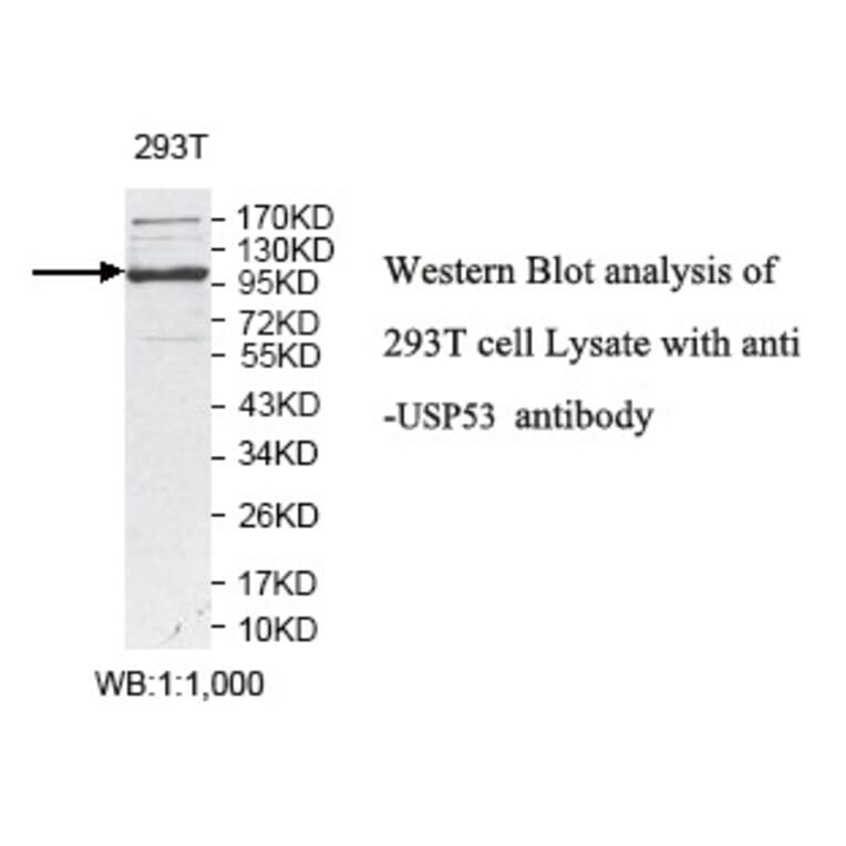 USP53 Antibody from Signalway Antibody (39788) - Antibodies.com
