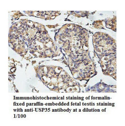 USP35 Antibody from Signalway Antibody (39789) - Antibodies.com